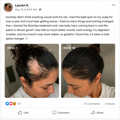 Nutrelya Patchy Hair Loss Treatment