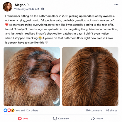 Nutrelya Patchy Hair Loss Treatment